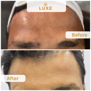 Image gallery marquee