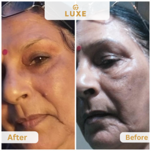 Image gallery marquee