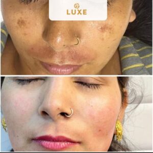 Image gallery marquee