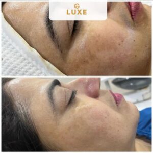 Image gallery marquee