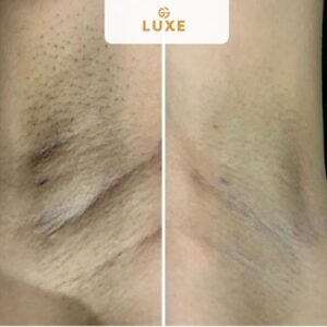 Image gallery marquee