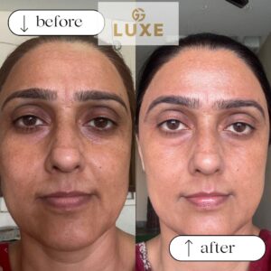 Image gallery marquee