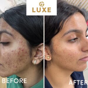 Image gallery marquee