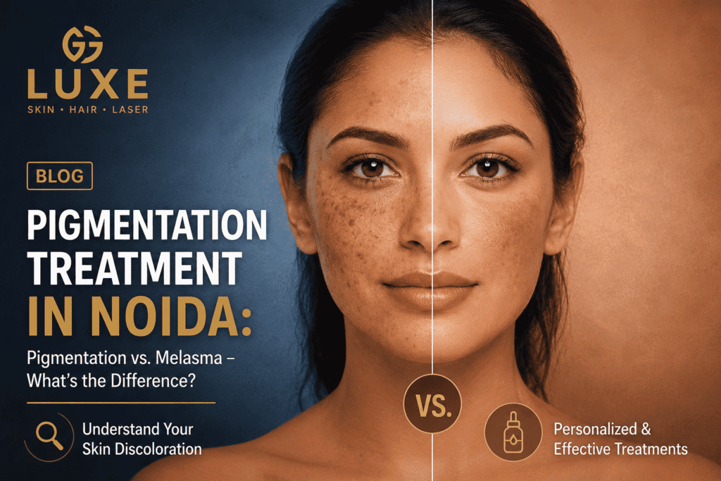 Pigmentation Treatment in Noida